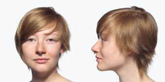 Foto: Rudolf Schäfer, aus: Female Faces 2011 – Emma (17), Halle (Saale), 2011 © Rudolf Schäfer Portrait einer Frau von der Seite und von vorn